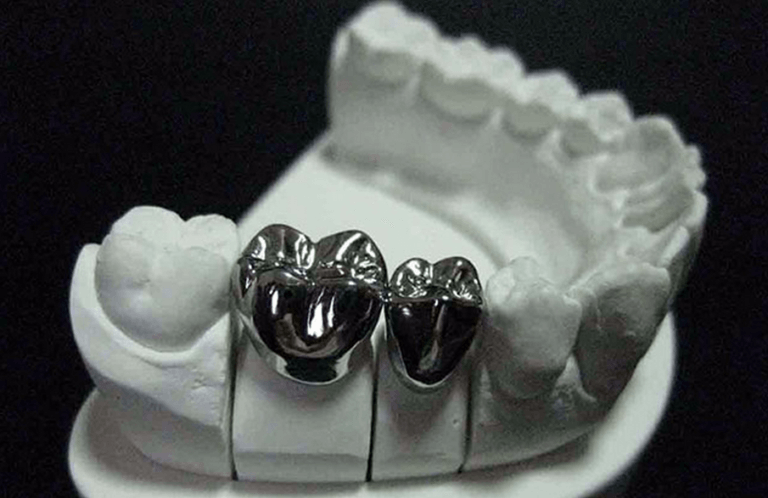 metal dental crowns