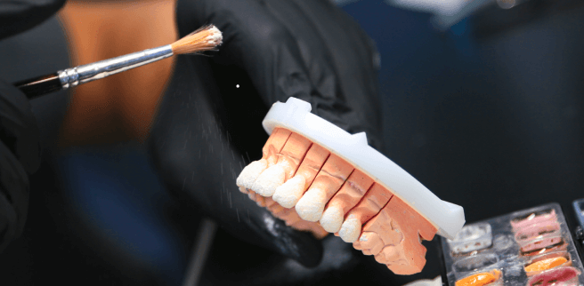Best Dental Restorations