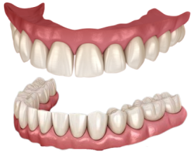 Dentures & Retainers